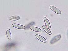 several partly transparent oval objects in a microscope field