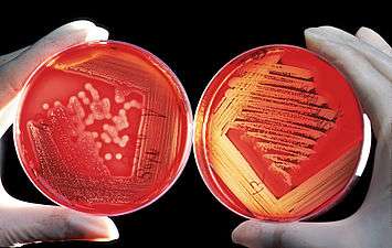 blood agar plate