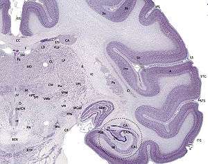 Brain slice showing areas CA1 and CA3 in hippocampus.