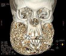 Deepthroat gagging video clips Victoria wright facial deformity u k