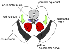 Depicts the substantia nigra.