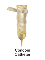 Condom Catheter Illustration