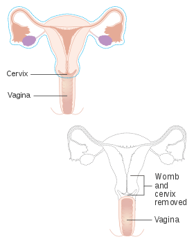 Dmoz vulva art