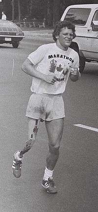 A young man with short, curly hair and an artificial right leg runs down a street. He wears shorts and a T-shirt that reads "Marathon of Hope"