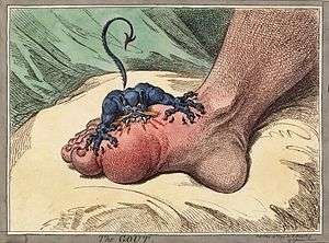 A small fierce creature with sharp teeth is biting into a swollen foot at the base of the big toe