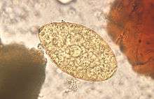 Micrograph of an unstained Echinostoma egg